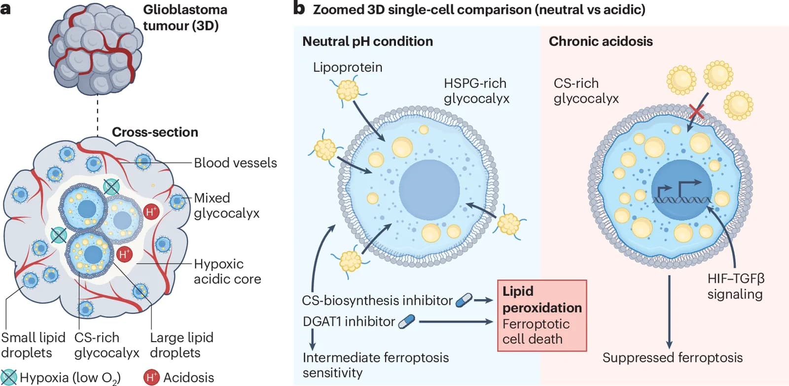 Glioblastoma diagram comparing neutral pH and chronic acidosis, glycocalyx changes, and suppressed ferroptosis